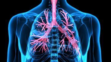 UARS-upper-airway-resistance-syndrom