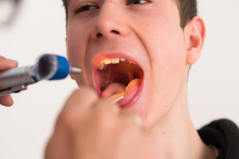 Die Uvula das Gaumenzäpfchen Welchen Sinn hat es?