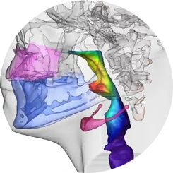 3D Planung der Atemwege